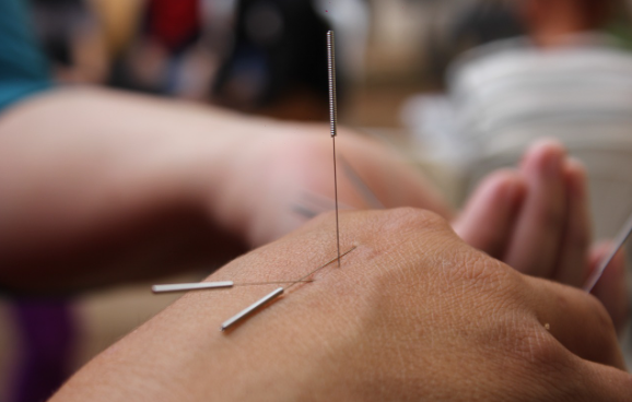 첩약 비용 실손 보험 청구 방법