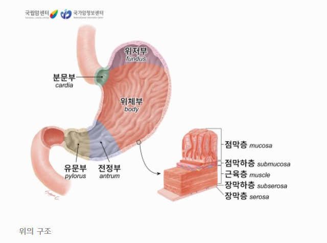 위암 초기 증상, 놓치지 말아야 할 경고 신호