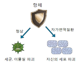 다발성 경화증 정보 관련 이미지