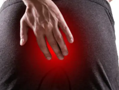 치질-증상-자가치료법-건강