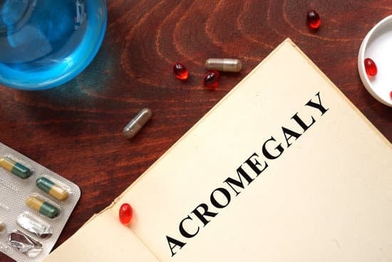 말단 비대증(Acromegaly): 원인, 증상, 치료