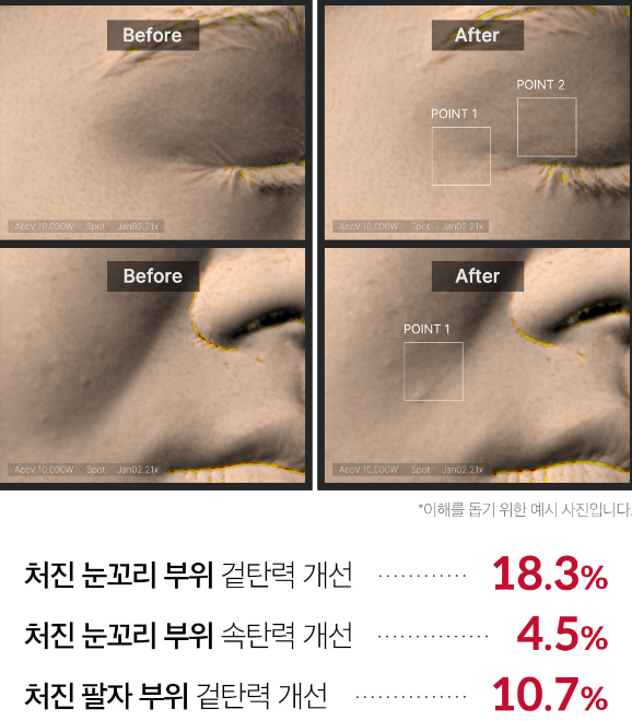 1회 사용으로 인한 피부 탄력 변화