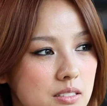 얼굴 비립종 없애는 법 자극 없이 제거하는 피부관리법_21
