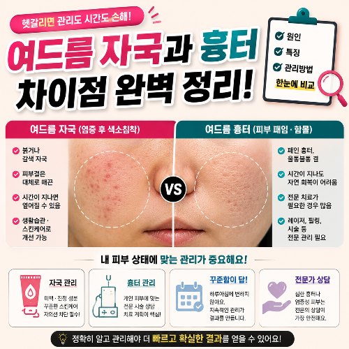 여드름 자국과 흉터 차이