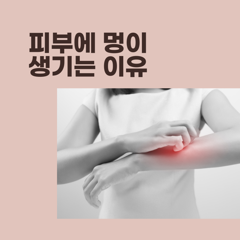 멍잘드는아이