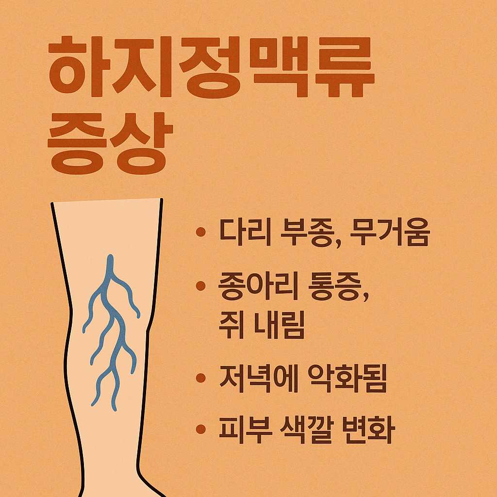 하지정맥류