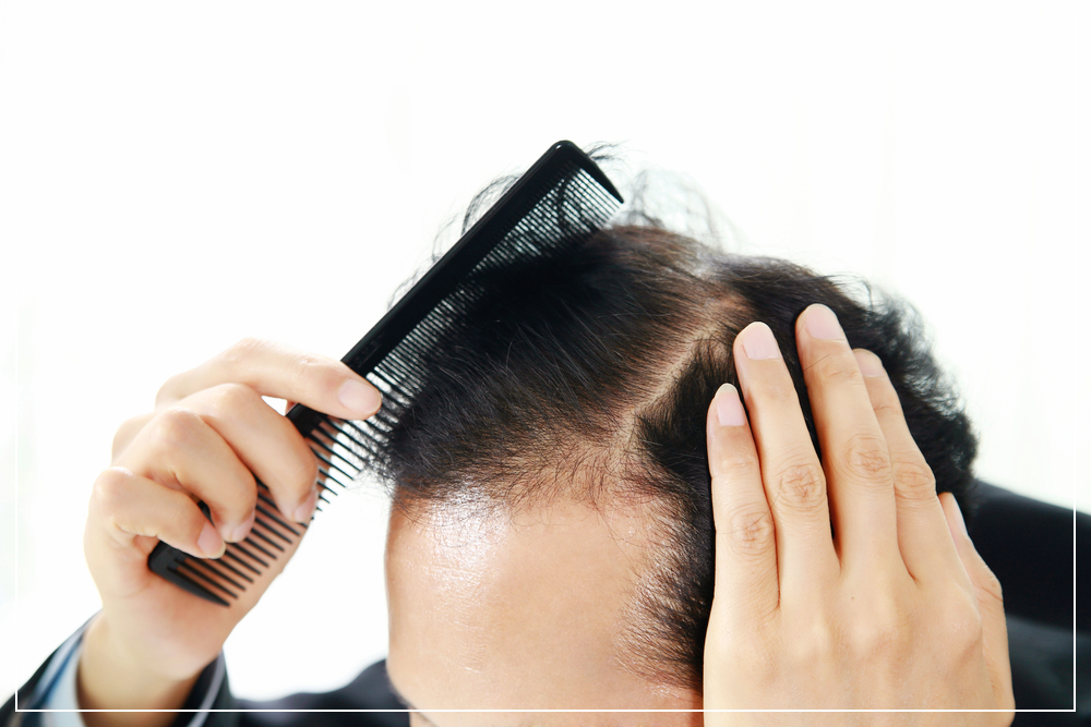 치커리-효능-탈모