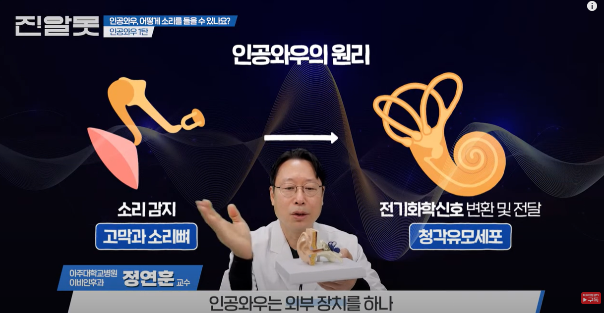 인공와우의 원리