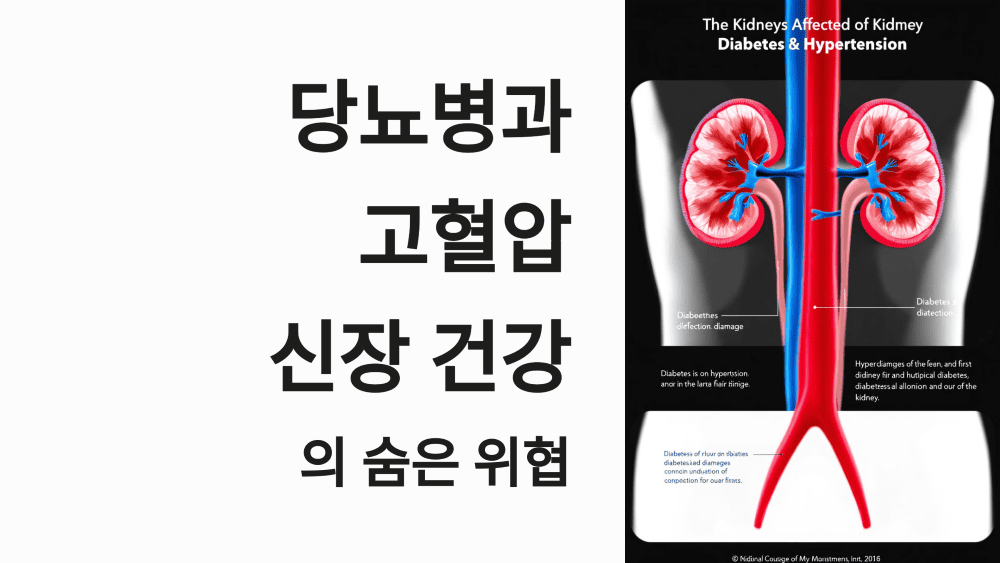 당뇨병과 고혈압이 신장을 망치는 이유