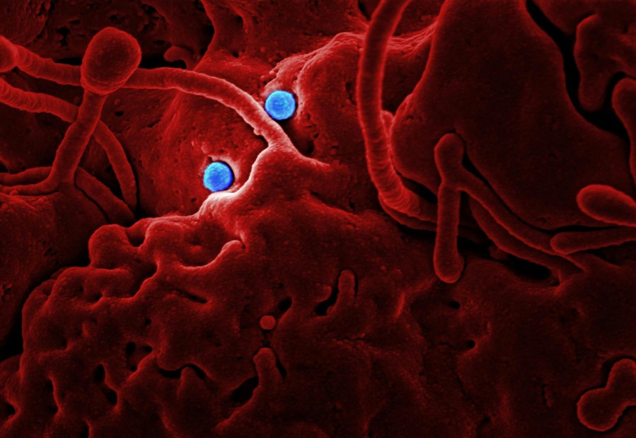 우리-몸속에-흐르고-있는-혈당을-나타내는-사진입니다.