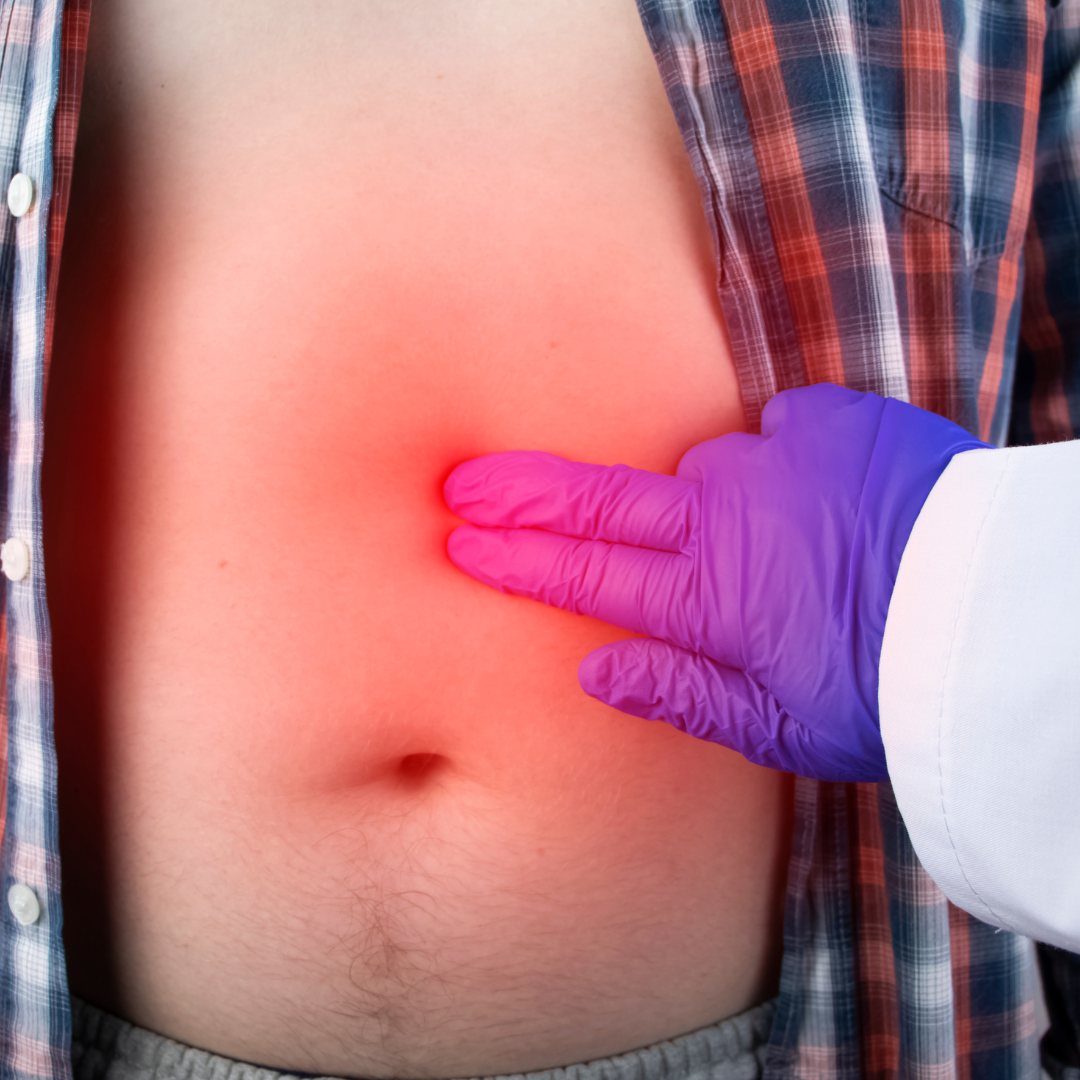 욕창 예방 치료 증상 원인