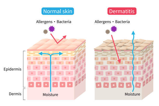 파나덤 크림&amp;#44; 피부질환 연고로 널리 쓰이는 외용 복합제 제품이 있습니다. 외용복합제품인 파다덤크림에는 항생제&amp;#44; 항진균제&amp;#44; 스테로이드 성분이 함유된 제품입니다. 3가지 성분을 함께 함유하고 있기 때문에 다양한 질병에 폭넓게 적용할 수 있는 장점이 있습니다. 어떤 효능이 있는지 글을 참고하세요.