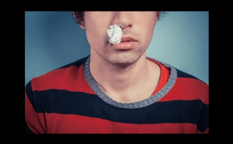 코피가 나서 휴지로 막고 있는 남자