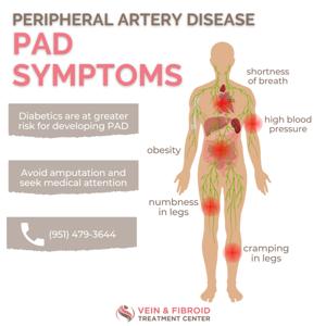 종아리 근육 뭉침