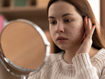 몸이 가려운 이유 31