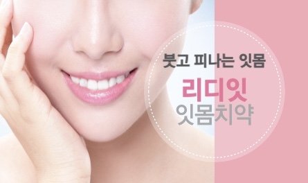 리디잇 치약 효능 효과 내돈내산 후기 부작용 리디에뜨 치약