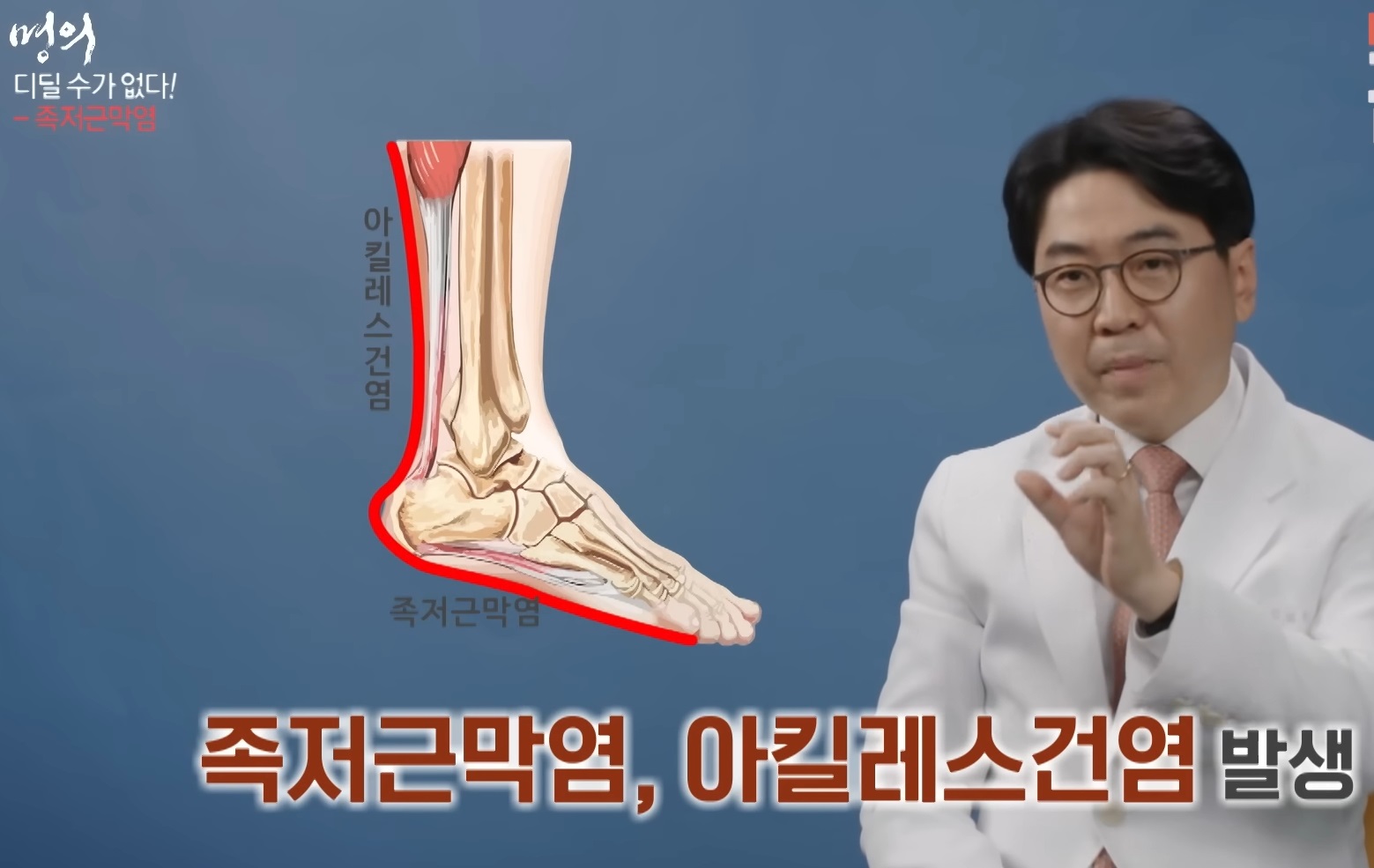 EBS-명의-발통증-족저근막염-최기원-교수