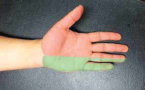 손가락 끝이 저린 이유