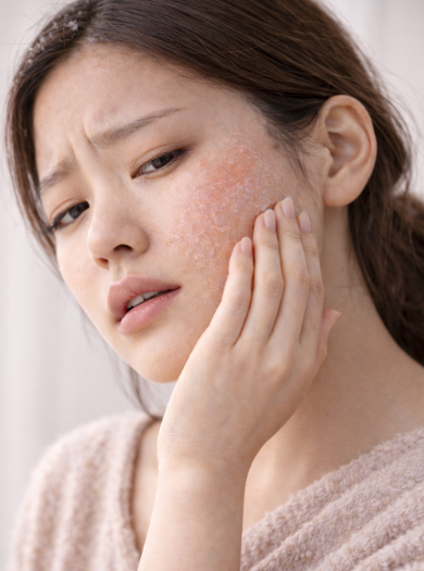 건조한 피부의 여자 이미지