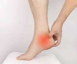 족저근막염 치료법