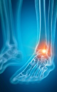 관절에 좋은 영양제