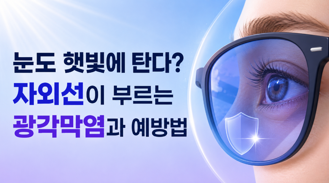 눈도 햇빛에 탄다? 자외선이 부르는 광각막염과 예방법