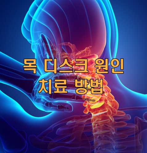 목디스크 증상