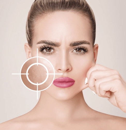 피부 재생크림과 수분크림 혼동, 여드름 흉터에는 뭐가 좋을까?