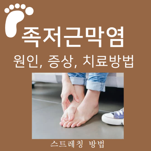 족저근막염 설명을 위한 아픈 발 사진