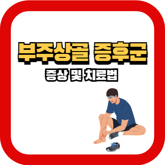 부주상골증후군
