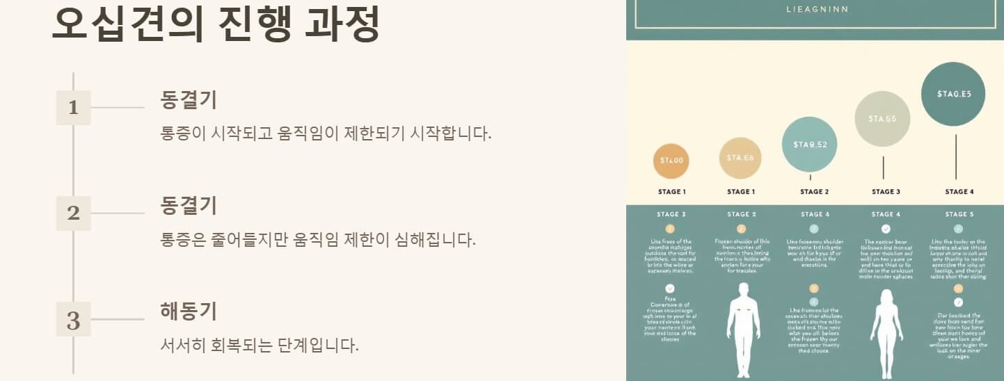 오십견 증상 치료방법
