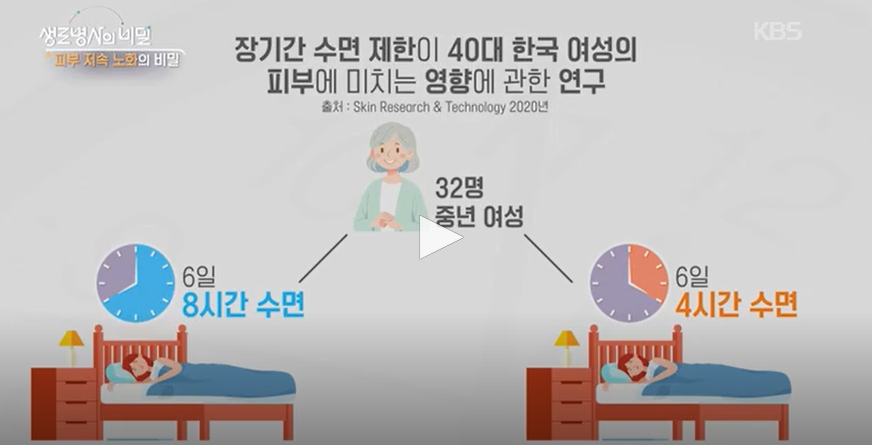피부 저속노화 실천법(생로병사의 비밀 974)