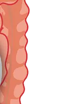 장이 부었을 때 증상, 원인, 해결방법까지! 지금 바로 확인하세요.