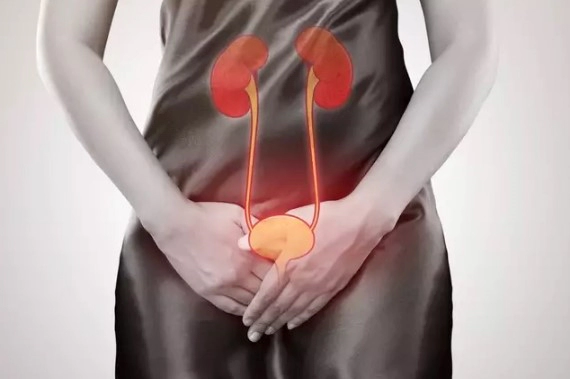 신우신염 방광염 차이