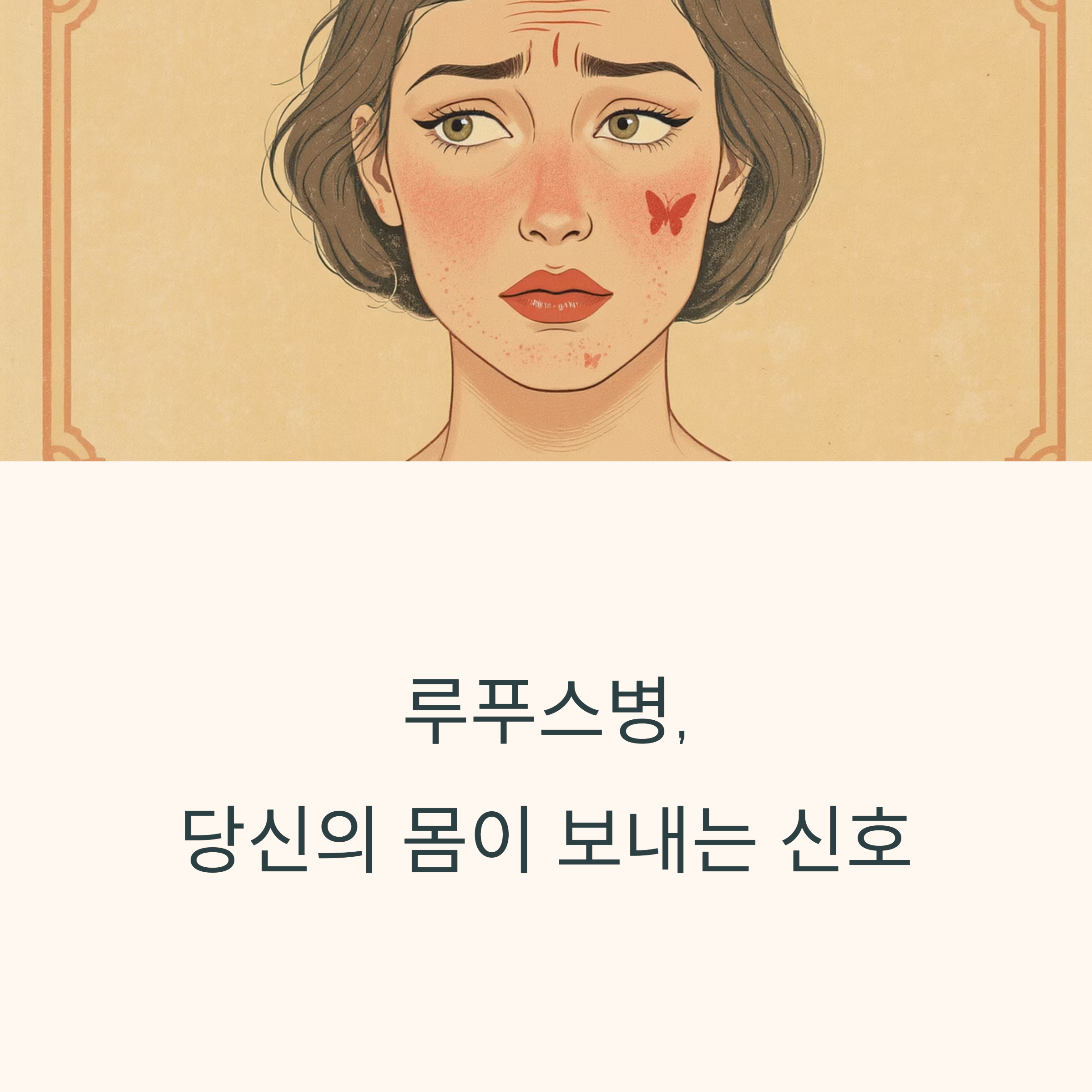 얼굴에 나비 모양 발진이 있는 여성 일러스트와 '루푸스병, 당신의 몸이 보내는 신호'라는 문구가 있는 이미지