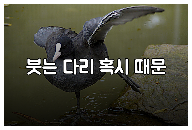 붓는 다리 혹시 때문