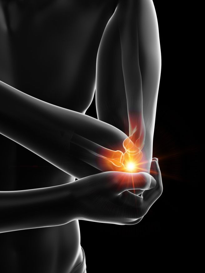 팔꿈치 바깥쪽 통증