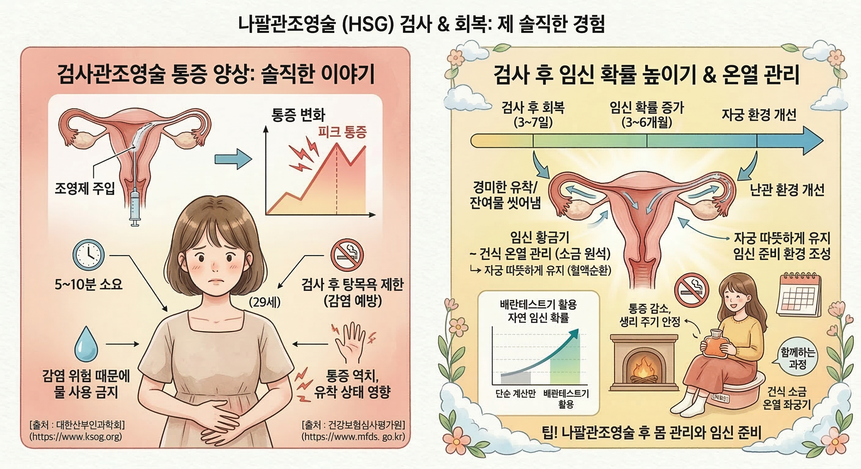 나팔관조영술 후기