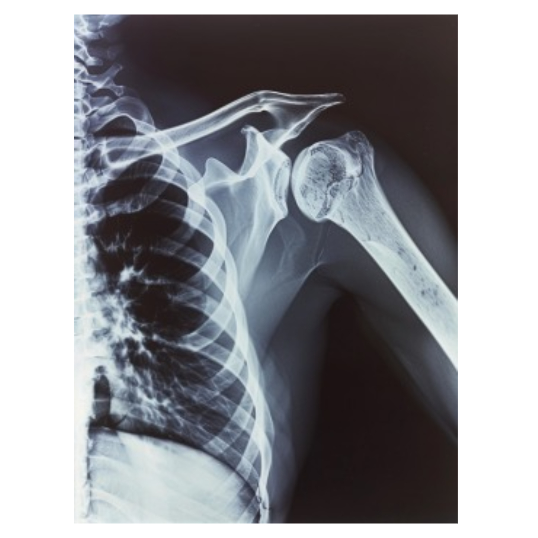 오십견과 관련된 사진입니다.