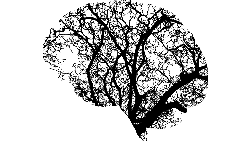 뇌 건강을 위한 도전적인 활동