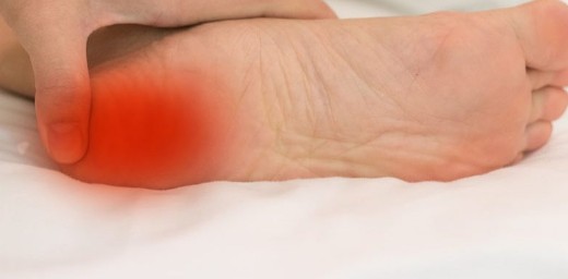 발바닥통증 원인 - 발바닥 앞쪽 통증, 발바닥 아치 통증, 발 뒤꿈치 통증