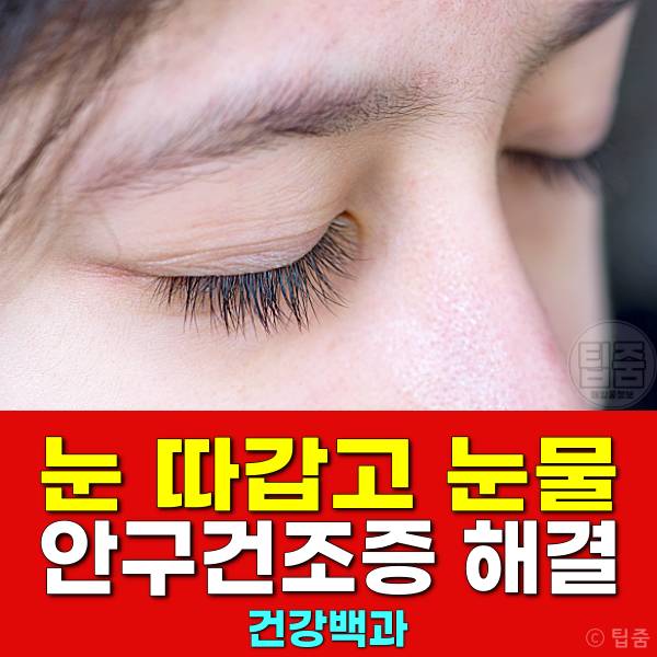 눈 따갑고 눈물 안구건조증 해결 눈뻑뻑함 이물감 눈건조증 원인