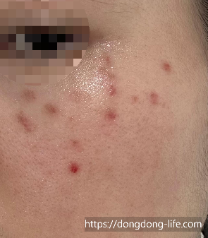 중계의원 기미 리뷰