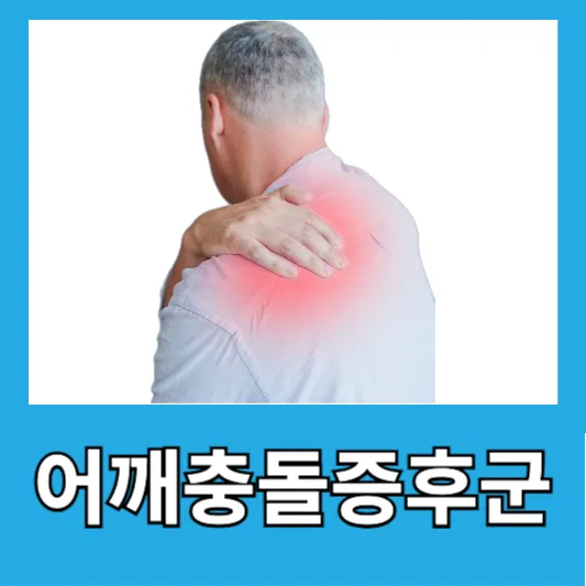 30~40대 직장인 어깨통증 어깨충돌증후군 원인 증상 치료방법