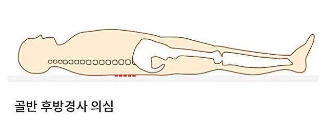 후방경사셀프체크누운자세