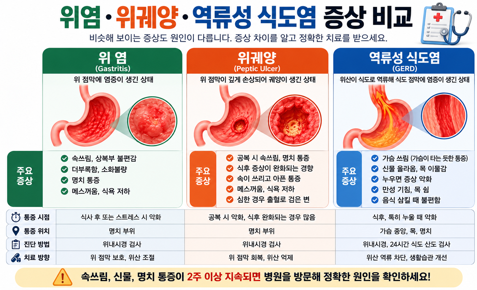 위염, 위궤양, 역류성 식도염의 대표 증상과 통증 양상 비교 이미지