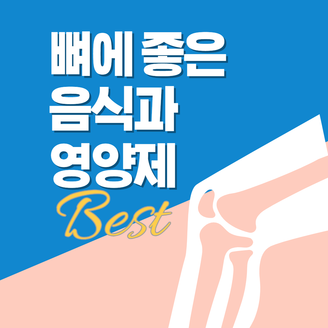 섬네일