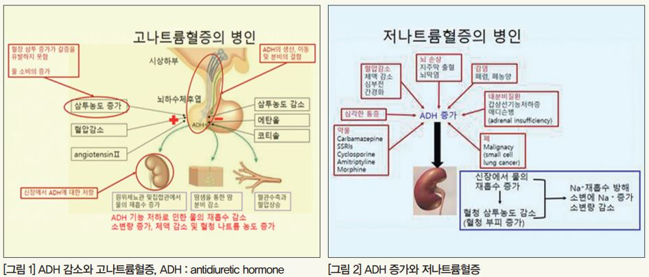 과도한 물과 채소 섭취의 위험성 분석 관련 이미지