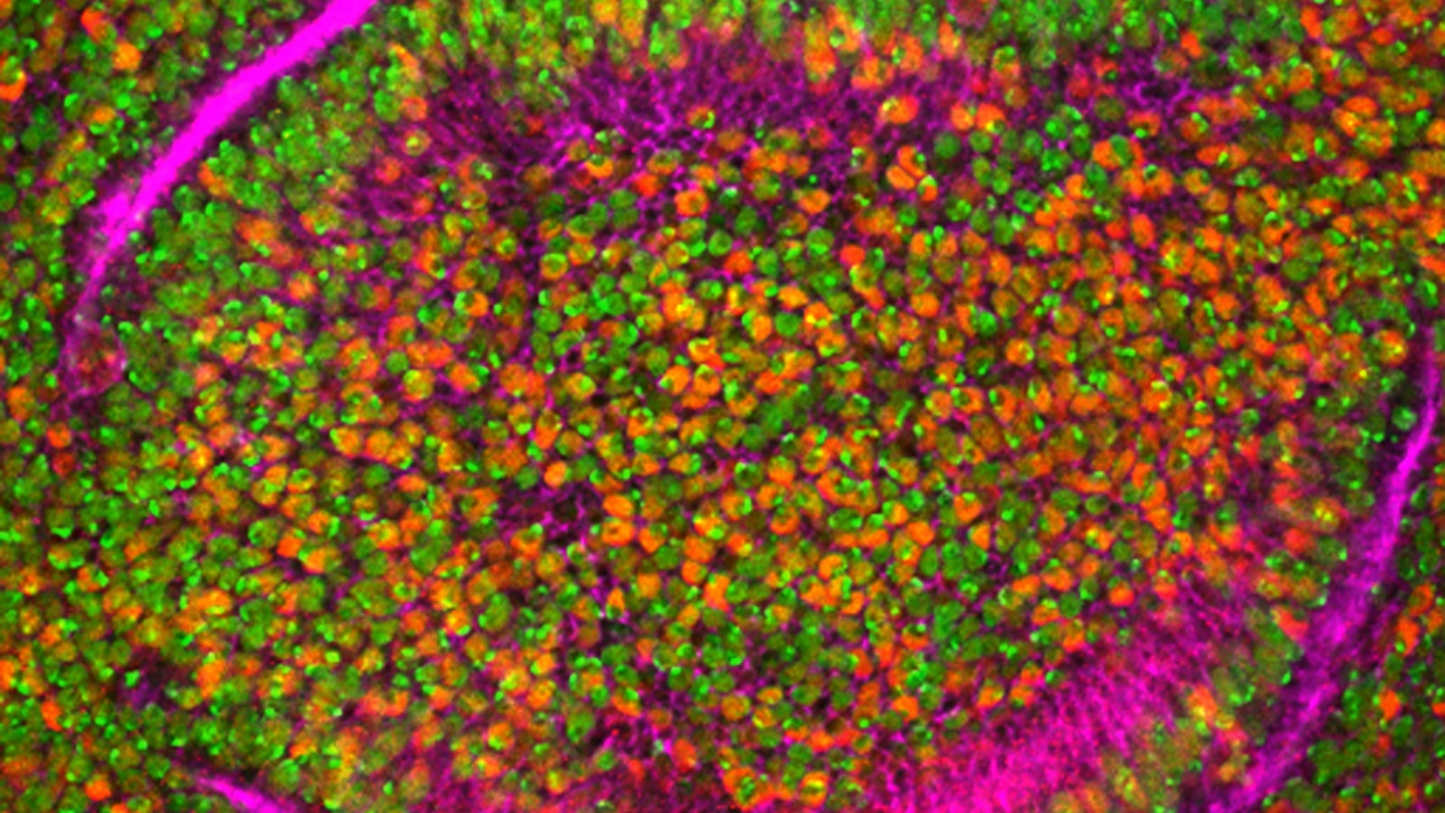 candidiasis and aspergillosis 5