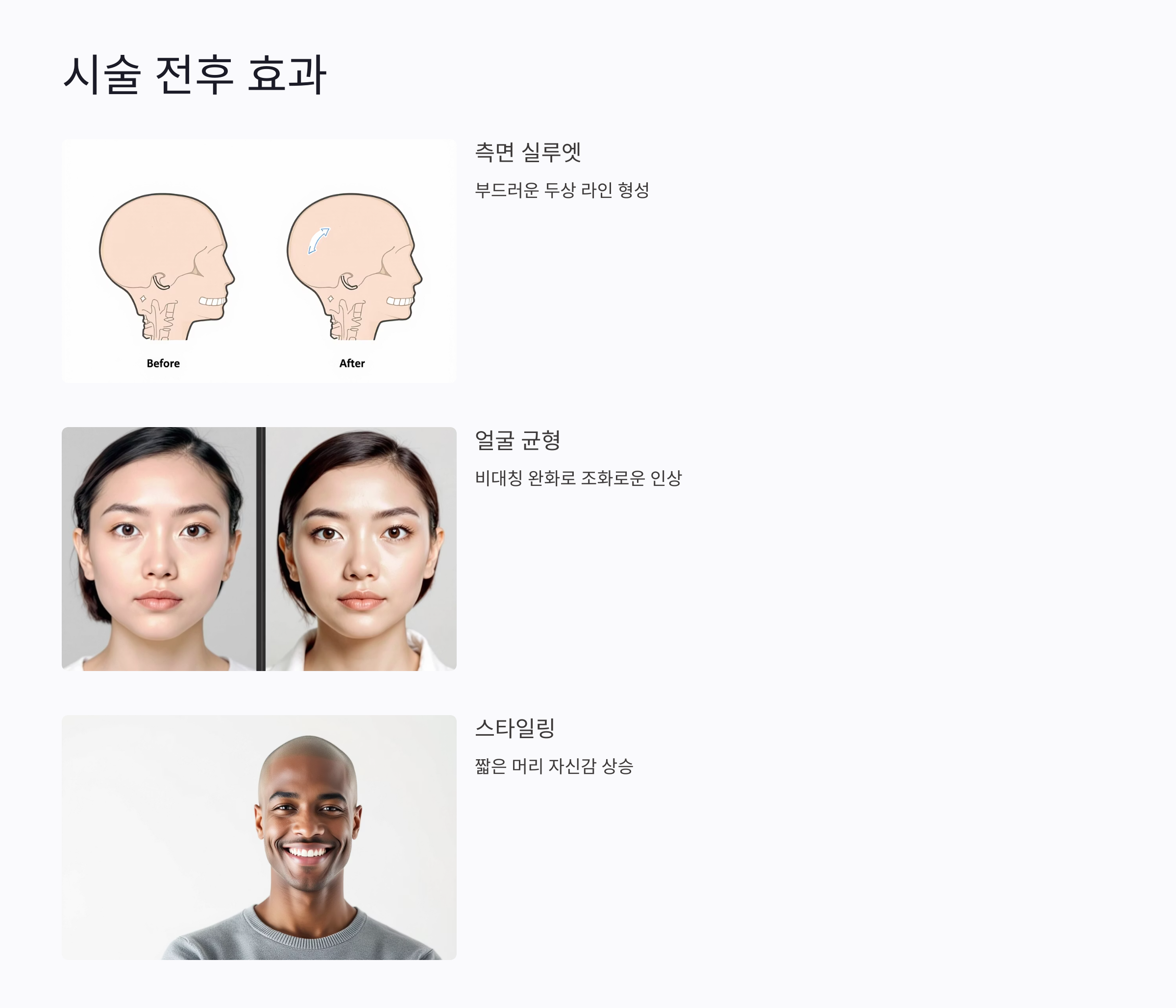 두상 불균형이 외모에 미치는 영향